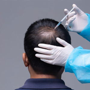 scalp injections for hair growth